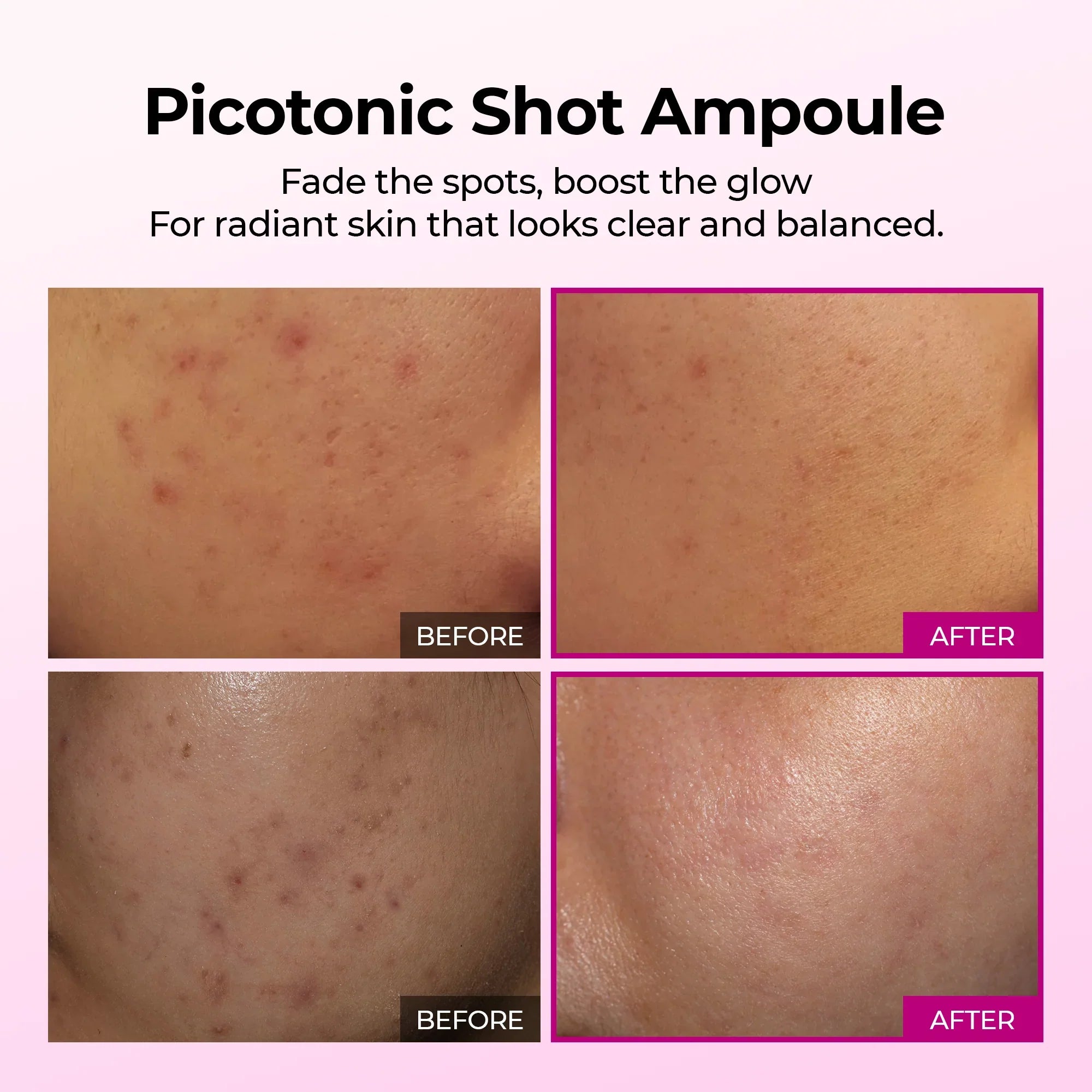 Picotonic Shot Pigmentation Ampoule